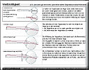 Fehlsichtige Augen.pdf